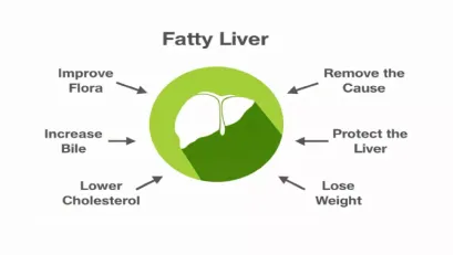 How to Reverse Fatty Liver Naturally: Expert-Recommended Diet Tips