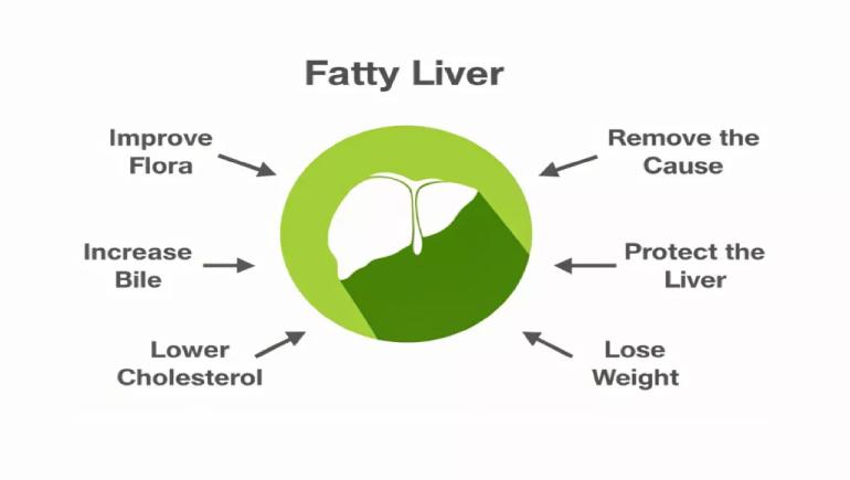 How to Reverse Fatty Liver Naturally: Expert-Recommended Diet Tips
